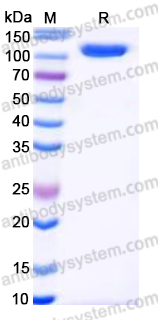 Recombinant Human SERPING1 Protein, C-His