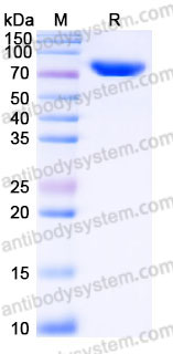 SDS-PAGE for Recombinant Human ALPL Protein, C-His ?>