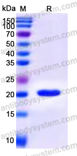Recombinant Human CLEC3B Protein, C-His