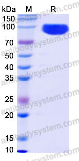 Recombinant Human BCHE/CHE1 Protein, C-His