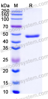 Recombinant Human CKM Protein, C-His