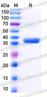 Recombinant Human CD23/FCER2 Protein, N-8*His