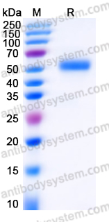 Recombinant Human LIPF Protein, C-His