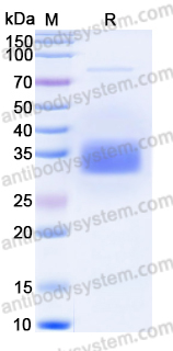 Recombinant Human CSN3 Protein, C-His