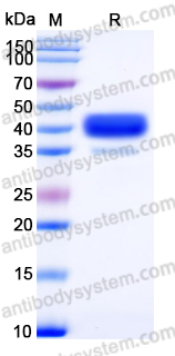 Recombinant Human CTSB Protein, C-His
