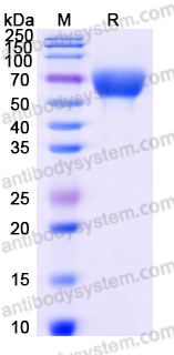Recombinant Human SERPINA6 Protein, C-His
