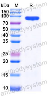 Recombinant Human GUSB Protein, C-His