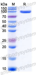 Recombinant Human PFKM Protein, C-His