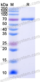 Recombinant Human MMP2 Protein, C-His