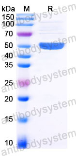 Recombinant Human HMBS Protein, C-His