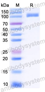 Recombinant Human CD10/MME Protein, N-8*His
