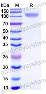 Recombinant Human CD45/PTPRC Protein, C-His