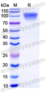 Recombinant Human CD45/PTPRC Protein, C-His