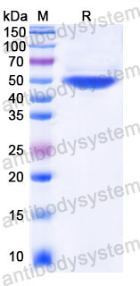 Recombinant Human CFH Protein, C-His