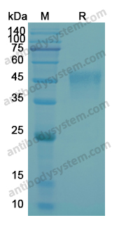 Recombinant Human CD16a/FCGR3A  (V176) Protein, C-His