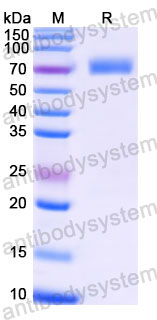 Recombinant Human CD126/IL6R/IL-6RA Protein, C-His
