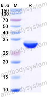 Recombinant Human CELA3A Protein, C-His