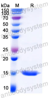 Recombinant Human CST2 Protein, C-His