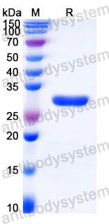 Recombinant Human QDPR Protein, C-His