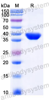 Recombinant Human FBP1 Protein, C-His