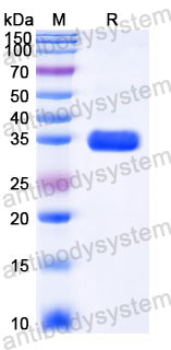 Recombinant Human SPARC/Osteonectin Protein, C-His