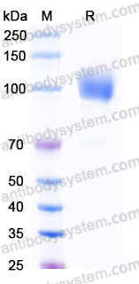 Recombinant Human CD140b/PDGFRB Protein, C-His
