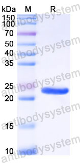 Recombinant Human CSH1 Protein, C-His