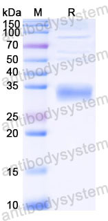 Recombinant Human CGB3/CGB Protein, C-His