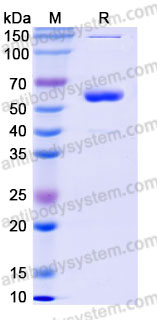 Recombinant Human VSIG8 Protein, C-Fc
