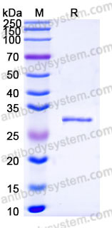Recombinant Human VSIG8 Protein, C-His