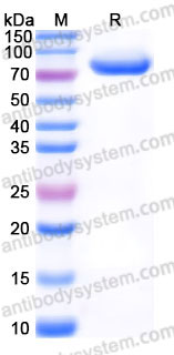 Recombinant Human OPN/Spp1 Protein, C-His