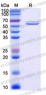 Recombinant Human CTSA Protein, C-His