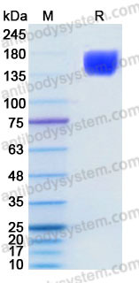 Recombinant Human CD117/KIT Protein, C-His