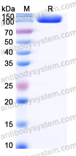 Recombinant Human CD117/KIT Protein, C-Fc