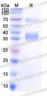 SDS PAGE for Recombinant Human CLU/Clusterin Protein, C-Fc-His ?>