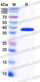 Recombinant Human PRPS2 Protein, C-His