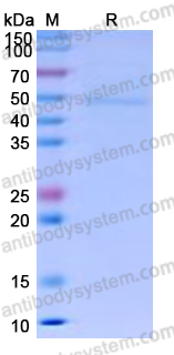 Recombinant Human CD64/FCGR1A Protein, C-His