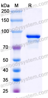 Recombinant Human SCG2 Protein, C-His