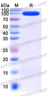 Recombinant Human CD56/NCAM1 Protein, C-His