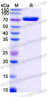 Recombinant Human PDIA4 Protein, C-His