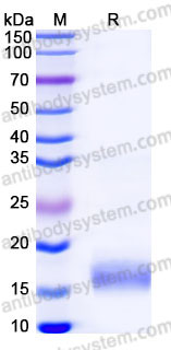Recombinant Human CD59 Protein, C-His