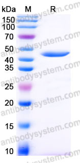Recombinant Human CTSE Protein, C-His
