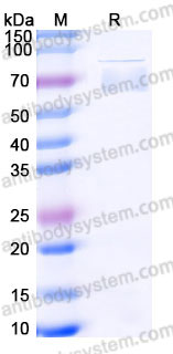 Recombinant Human CD62L/SELL Protein, C-His