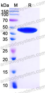 Recombinant Human CPB1 Protein, C-His