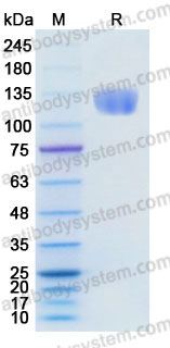 Recombinant Human CD13/ANPEP/APN Protein, C-His