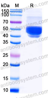 Recombinant Human CD75/ST6GAL1 Protein, C-His