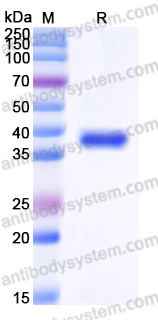 Recombinant Human CD326/EPCAM Protein, C-His