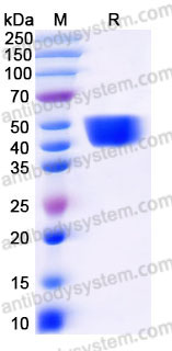 Recombinant Human DPEP1 Protein, C-His