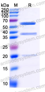 Recombinant Human CPE Protein, C-His
