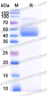 Recombinant Human CD127/IL7R Protein, C-His